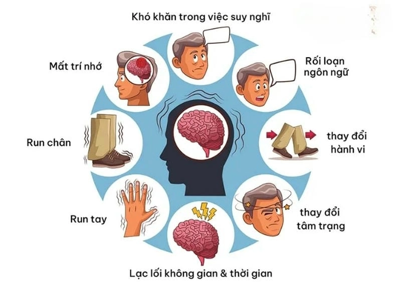 Tìm hiểu cơ chế thoái hóa thần kinh thông qua ảnh minh họa
