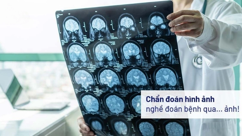 Chẩn đoán hình ảnh là gì và vai trò trong y học hiện đại