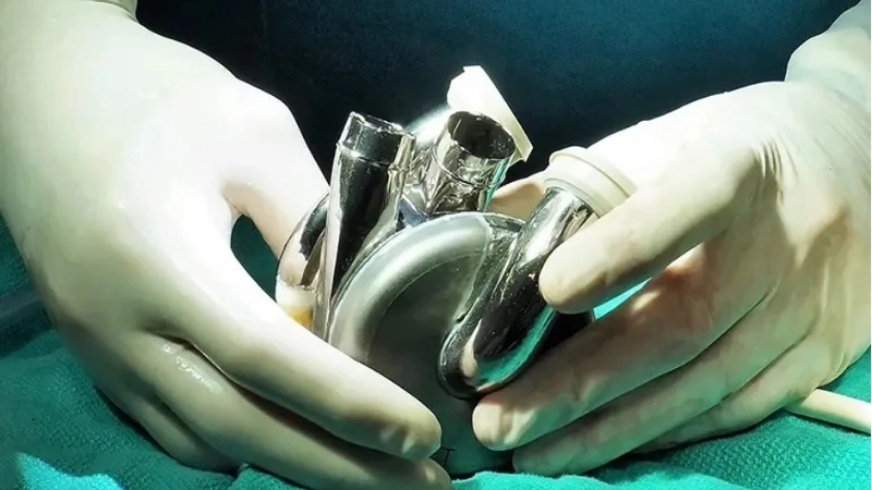 Công nghệ cấy ghép là gì và cơ chế hoạt động