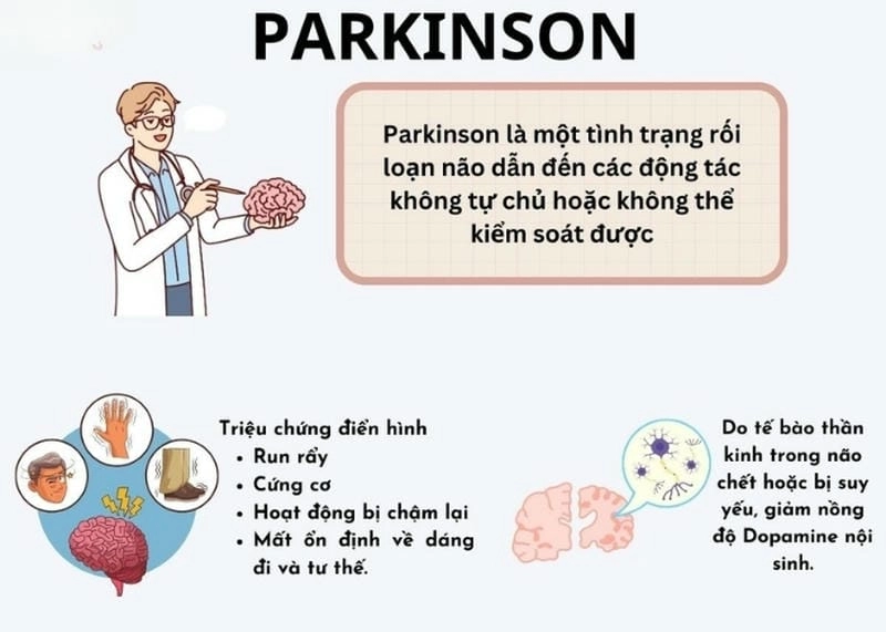 Giải mã bệnh Parkinson là gì qua hình ảnh trực quan