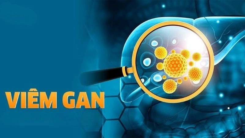 Viêm gan là tình trạng sưng, viêm xảy ra khi gan bị tổn thương hoặc nhiễm trùng