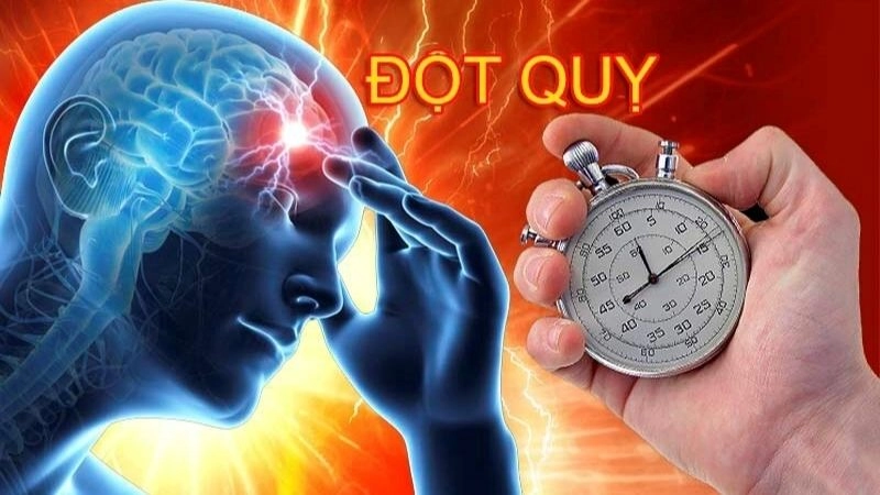 Đột quỵ còn được gọi là tai biến mạch máu não