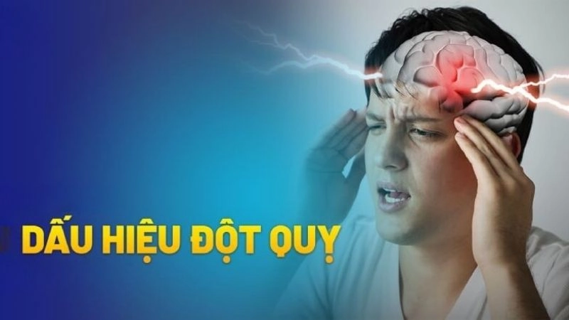 Các dấu hiệu đột quỵ có thể xuất hiện và biến mất rất nhanh