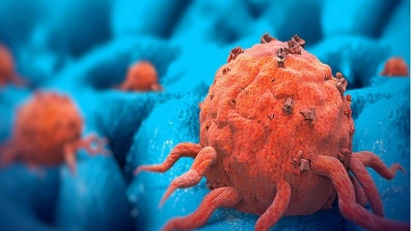 ế bào gốc có thể hỗ trợ điều trị một số bệnh lý, trong đó có một số bệnh ung thư