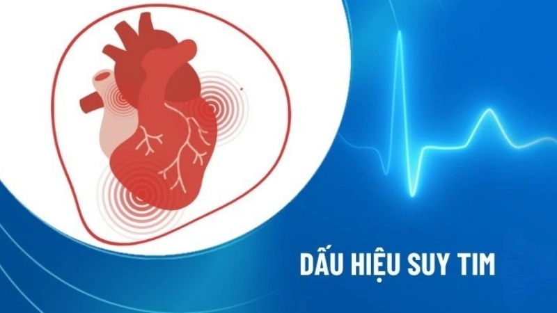 Dấu hiệu suy tim cần nhận biết sớm 
