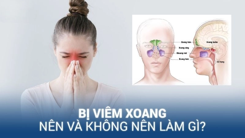 Hiểu rõ triệu chứng của viêm xoang không chỉ giúp điều trị kịp thời 