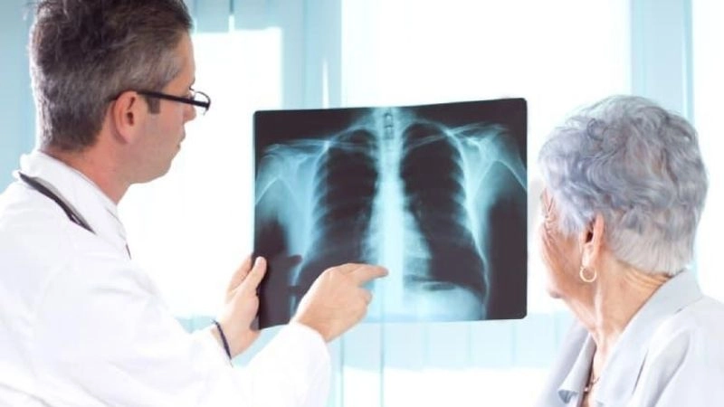 Biện pháp phòng ngừa và kiểm soát bệnh phổi kẽ