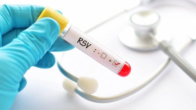 Virus hợp bào hô hấp - RSV (respiratory syncytial virus) là một trong những nguyên nhân gây ra bệnh đường hô hấp ở trẻ