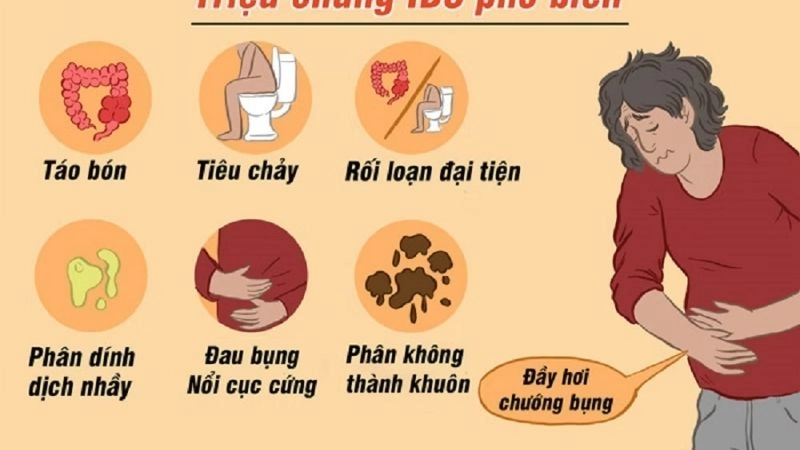 Triệu chứng hội chứng ruột kích thích