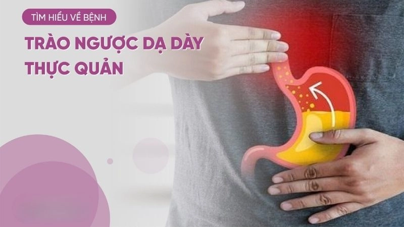 Trào ngược dạ dày thực quản (GERD) hay gọi là trào ngược dạ dày 