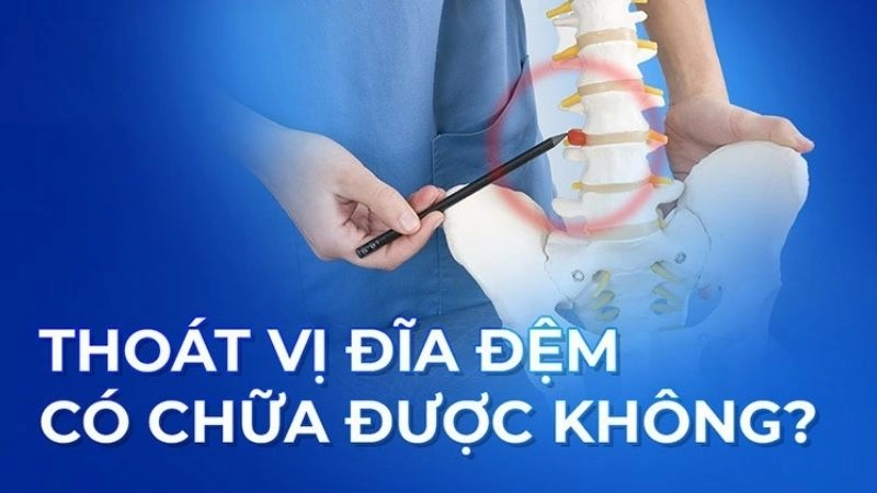 Đĩa đệm bị thoát vị có được chữa trị khỏi hay không sẽ còn phụ thuộc