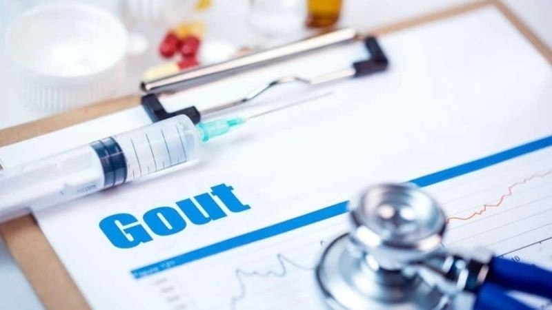 phương pháp điều trị gout tùy thuộc ào mức độ của ệnh