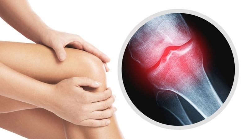 Các dấu hiệu viêm gân thường gặp