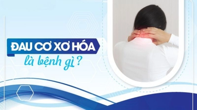 Đau cơ xơ hóa (tiếng Anh: Fibromyalgia) là một tình trạng đặc trưng bởi cơn đau khắp cơ thể