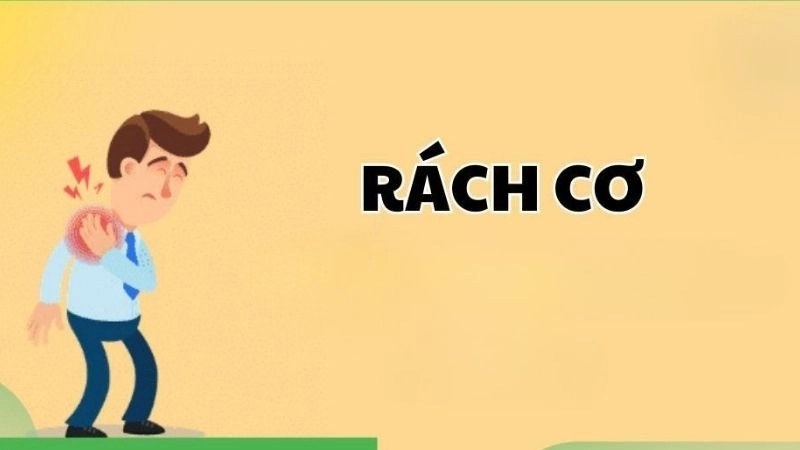 Rách cơ là hiện tượng cơ hoặc gân ở cơ do bị căng, giãn ra dẫn đến rách