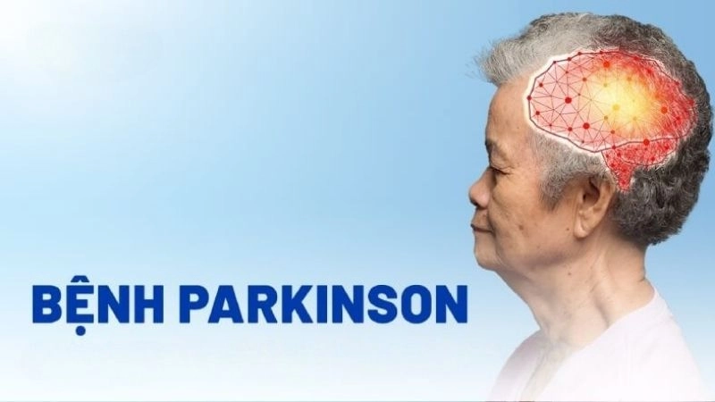 Bệnh Parkinson là một bệnh lý thần kinh
