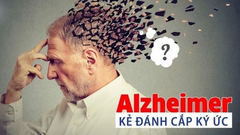Alzheimer gây Sa sút trí nhớ và khả năng nhận thức