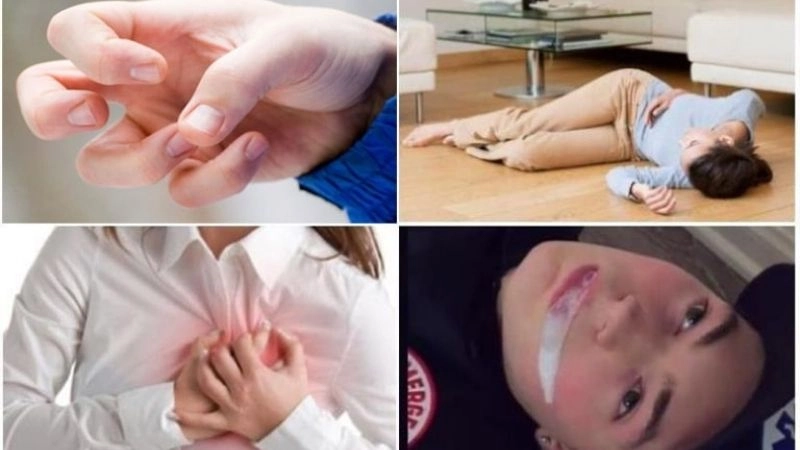 Triệu chứng hay dấu hiệu động kinh khá đa dạng