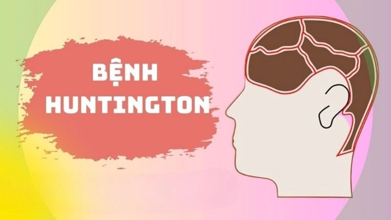 Giải mã nguyên nhân khiến Huntington khó điều trị