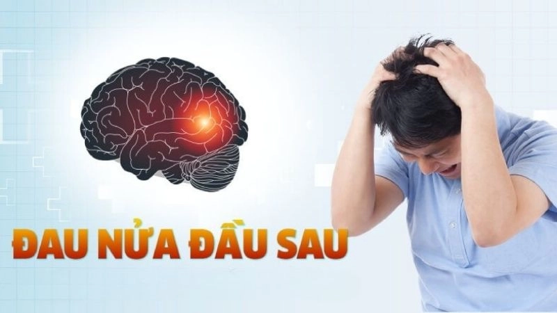 Làm thế nào để điều trị đau nửa đầu hiệu quả và an toàn?
