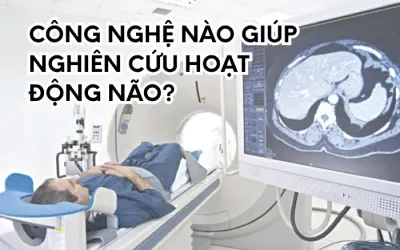 Thiết bị nào đang giúp quan sát hoạt động não người?