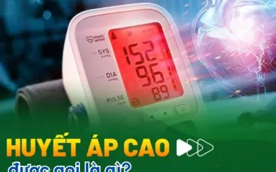 Huyết áp cao là gì và ảnh hưởng đến sức khỏe ra sao?