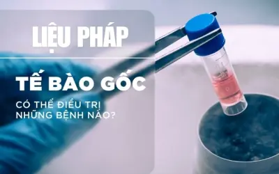 Những căn bệnh có thể chữa nhờ liệu pháp tế bào gốc?
