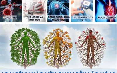 Những loại bệnh phổ biến liên quan đến quá trình lão hóa