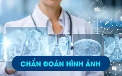 Tìm hiểu chẩn đoán hình ảnh là gì và có ý nghĩa ra sao?