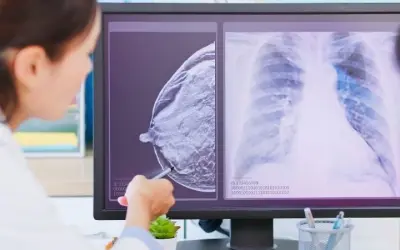 Công nghệ nào giúp phát hiện ung thư sớm nhất hiện nay