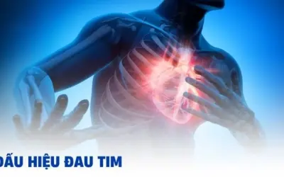 Dấu hiệu đau tim - Làm thế nào để phát hiện kịp thời?