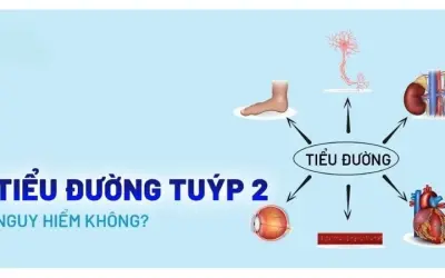 Nhận biết bệnh tiểu đường loại 2 qua dấu hiệu ban đầu