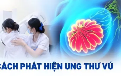 Dấu hiệu nhận biết ung thư vú sớm và cách kiểm tra vú