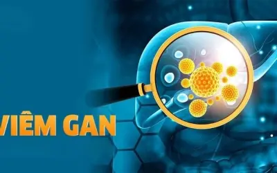Triệu chứng của bệnh viêm gan là gì? Dấu hiệu cảnh báo