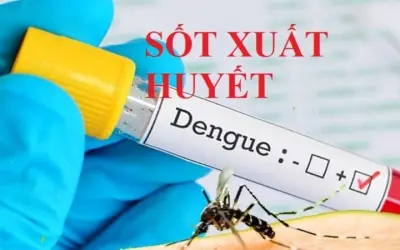 Triệu chứng của sốt xuất huyết là gì và cách phòng tránh