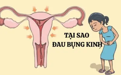 Tại sao đau bụng kinh nguyệt lại phổ biến ở phụ nữ?