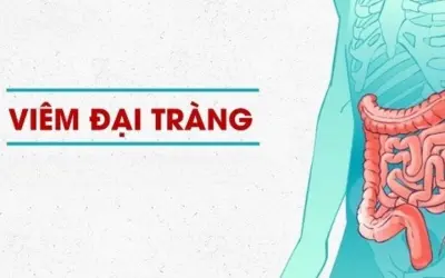 Triệu chứng của viêm đại tràng là gì? Dấu hiệu phổ biến