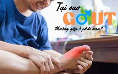 Gout ở nam giới - Nguyên nhân nào làm gia tăng nguy cơ?