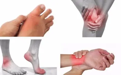 Triệu chứng của bệnh viêm khớp là gì và mức độ nguy hiểm