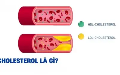 Làm thế nào để giảm cholesterol bằng chế độ ăn uống?