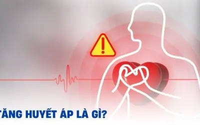 Huyết áp cao - Hiểm họa âm thầm cho sức khỏe tim mạch