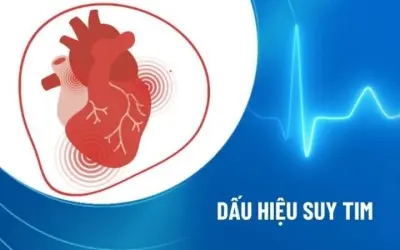 Cảnh báo suy tim qua dấu hiệu ban đầu - Đừng chủ quan