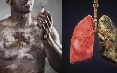 Tại sao hút thuốc lá là nguyên nhân gây ung thư phổi?