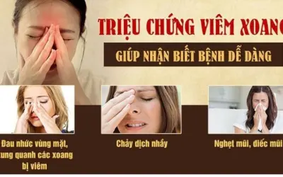 Triệu chứng của viêm xoang là gì và cách nhận biết sớm