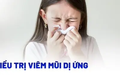 Phương pháp điều trị viêm mũi dị ứng được khuyên dùng