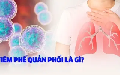 Làm thế nào để phòng ngừa viêm phế quản hiệu quả?