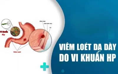 Tại sao vi khuẩn HP là nguyên nhân gây viêm dạ dày?