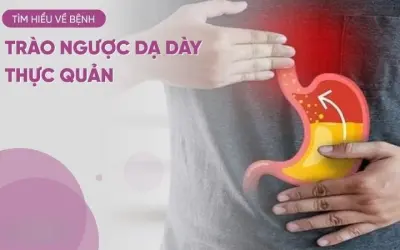 Trào ngược dạ dày thực quản là gì? Có chữa được không
