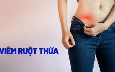 Làm thế nào để nhận biết sớm dấu hiệu viêm ruột thừa?