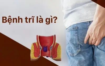 Nguyên nhân phổ biến gây bệnh trĩ ở người lớn tuổi